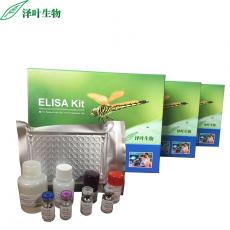 Human (CAMK2α)ELISA Kit