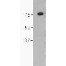 Anti-Complement C4(β chain) antibody