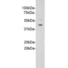 Anti-IL1RL1 antibody