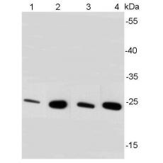 Anti-BDNF antibody