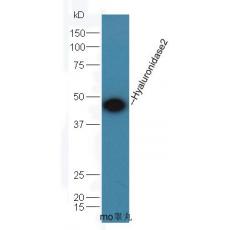 Anti-Hyaluronidase2 antibody