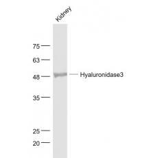 Anti-Hyaluronidase3 antibody