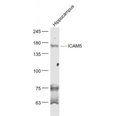 Anti-ICAM5 antibody