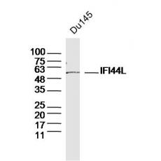 Anti-IFI44L antibody