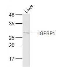 Anti-IGFBP4 antibody