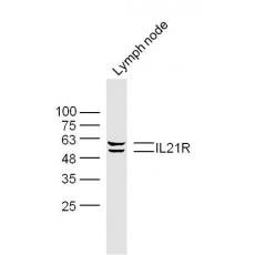 Anti-IL21R antibody