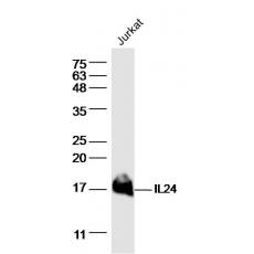 Anti-IL24 antibody