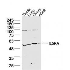 Anti-IL5RA antibody