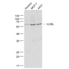 Anti-ILVBL antibody