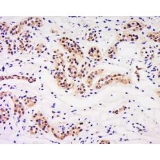 Anti-LIN9 antibody