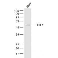 Anti-LOX 1 antibody