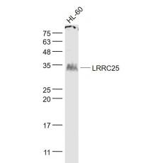 Anti-LRRC25 antibody