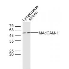 Anti-MAdCAM-1 antibody