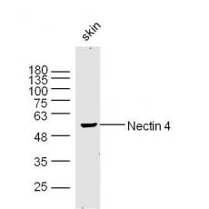 Anti-Nectin 4 antibody