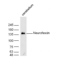 Anti-Neurofascin antibody