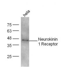 Anti-Neurokinin 1 Receptor antibody