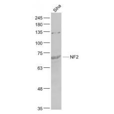 Anti-NF2 antibody