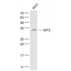 Anti-NIT2 antibody