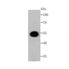 Anti-Fusion glycoprotein F0 antibody