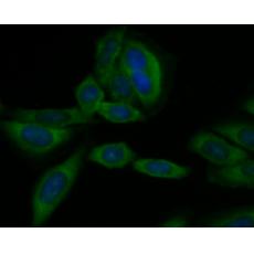 Anti-CD40 antibody