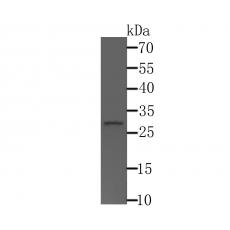 Anti-CTDSPL antibody