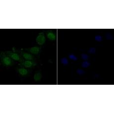 Anti-delta 1 Catenin/CAS antibody