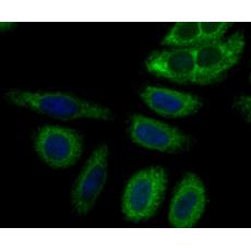 Anti-Perforin antibody