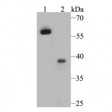 Anti-Estrogen Receptor alpha antibody