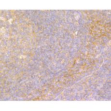 Anti-IL-22 antibody