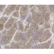 Anti-Cytokeratin 8 antibody