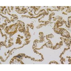 Anti-Mesothelin antibody