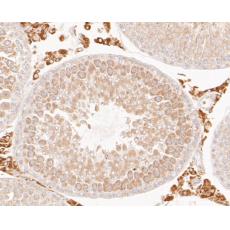 Anti-FH antibody