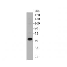 Anti-ACADL antibody