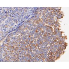 Anti-FSH beta antibody