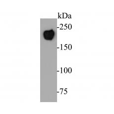 Anti-CD45 antibody