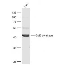 Anti-B4GALNT1/GM2 synthase antibody