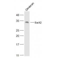 Anti-BarX2 antibody