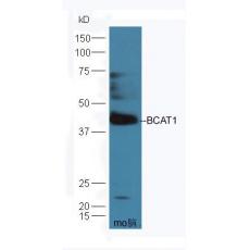 Anti-BCAT1 antibody