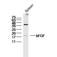 Anti-bFGF antibody