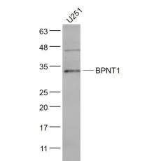 Anti-BPNT1 antibody