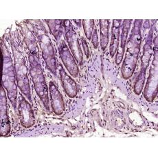 Anti-BRMS1 antibody