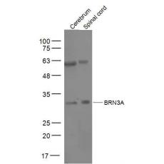 Anti-BRN3A antibody