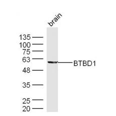 Anti-BTBD1 antibody