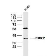 Anti-BXDC2 antibody