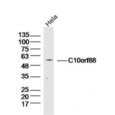 Anti-C10orf88 antibody