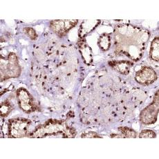 Anti-C10orf4 antibody