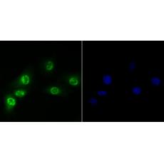 Anti-Brd4 antibody