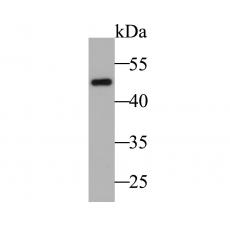 Anti-Cytokeratin 17 antibody