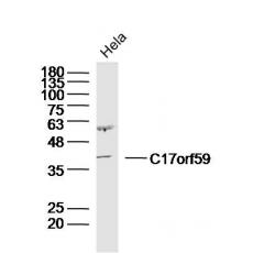 Anti-C17orf59 antibody