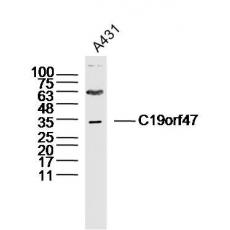 Anti-C19orf47 antibody